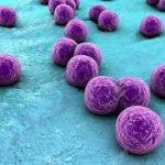Staphylococcus Aureus
