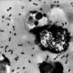 Bubonic Plague