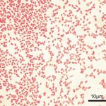 Gram-Negative Bacteria