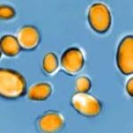 Emerging Zoonotic Pathogen Streptococcus suis in Europe