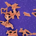 World TB Day 2024 – Yes! We Can End TB!
