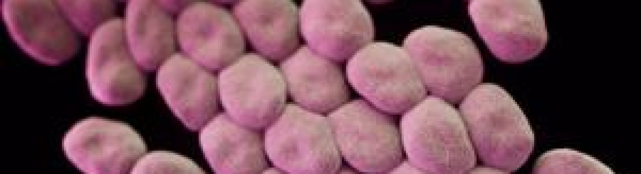 Multidrug-Resistant Pathogens - Trana Discovery